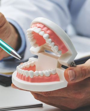 Dental Bridges Near Me Serving Bay Area, San Jose, CA 
