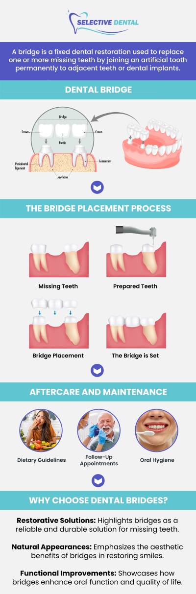 Dental bridges can help replace missing teeth, restore comfortable chewing, support clearer speech, and maintain proper spacing between remaining teeth. At Selective Dental, Dr. Victoria Vuong, DDS, and our team provide personalized evaluations to determine whether a bridge is appropriate based on gum health, supporting teeth, bite alignment, and long-term restorative goals. Patients throughout San Jose and the Bay Area can also receive clear guidance about treatment costs, financing options, and ongoing care to help them make informed decisions about restoring their smiles. Contact us today for more information or schedule an appointment online. We are conveniently located at 3151 South White Road, Suite 203 San Jose, CA 95148.