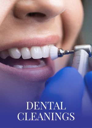 Dental Cleanings Serving in Bay Area, San Jose, CA