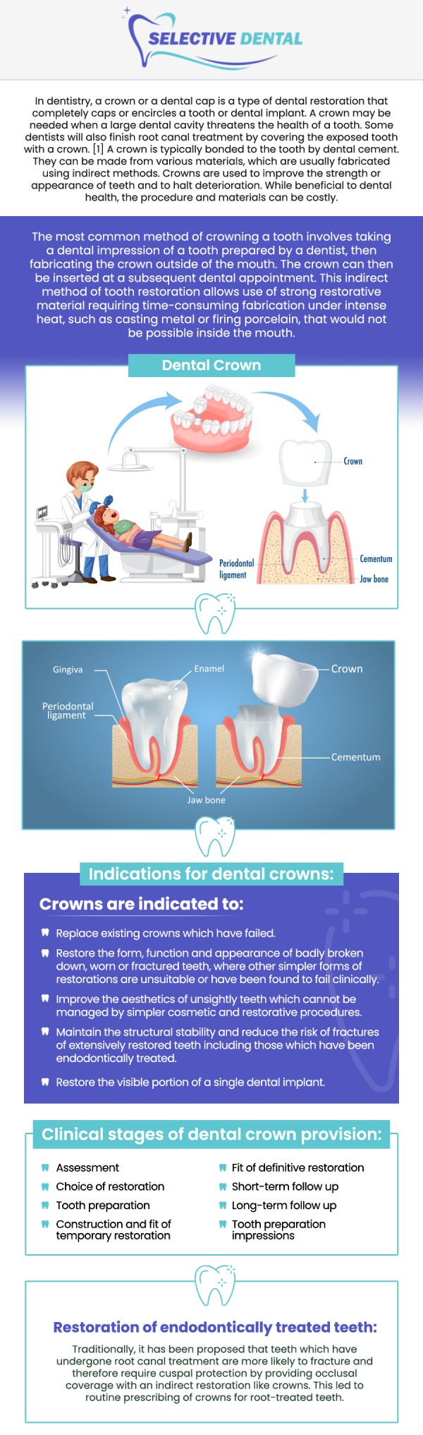 At Selective Dental, Dr. Victoria Vuong, DDS, is dedicated to providing high-quality dental crowns that align with your oral health and financial needs. Dental crowns typically range from $700 to $2,500 per tooth, depending on the material, location, and specific treatment plan. We strive to offer affordable options to help you achieve a healthier smile without compromising your budget. For more information, contact us today or book an appointment. We are conveniently located at 3151 South White Road, Suite 203 San Jose, CA 95148.