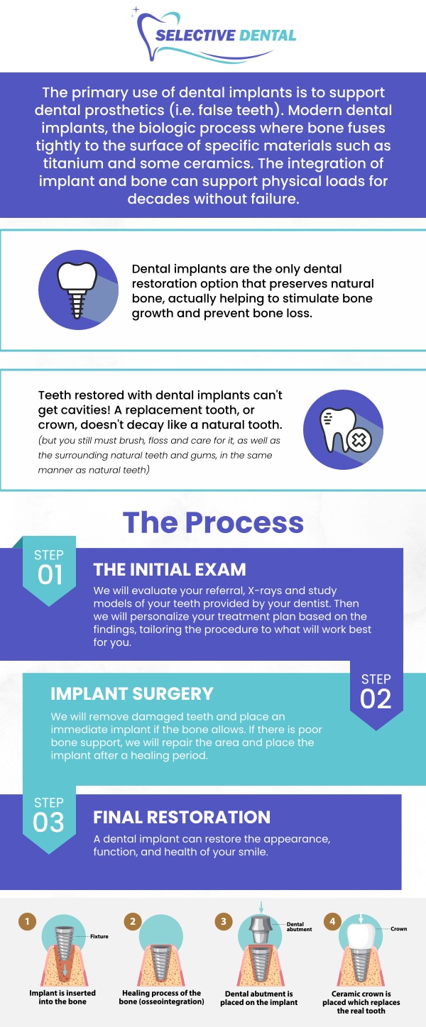 Dental implants are a highly effective solution for replacing missing teeth caused by decay, injury, or gum disease. This treatment not only improves the appearance of your smile but also restores functionality and supports long-term oral health. At Selective Dental, Dr. Victoria Vuong, DDS, provides personalized, high-quality care to ensure that each patient achieves the best possible outcome. With advanced technology and a commitment to patient comfort, we make your dental implant experience smooth and successful. Contact us today for more information or schedule an appointment online. We are conveniently located at 3151 South White Road, Suite 203 San Jose, CA 95148.