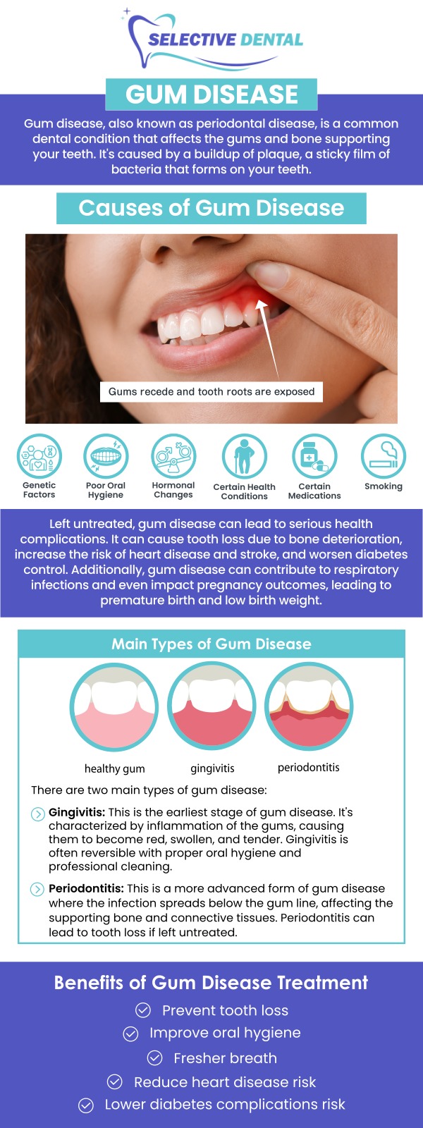 Gum diseases such as gingivitis and periodontitis are caused by oral bacteria that lead to plaque and tartar buildup on the teeth and gums. If left untreated, these conditions can result in severe oral health problems, including tooth loss and damage to the bone supporting your teeth. Dr. Victoria Vuong, DDS, at Selective Dental provides expert care to prevent and treat gum diseases. Through regular check-ups, professional cleanings, and personalized treatment plans, Dr. Vuong ensures your gums stay healthy and your smile remains bright. For more information, contact us today or schedule an appointment online. We are conveniently located at 3151 South White Road, Suite 203 San Jose, CA 95148. Gum diseases such as gingivitis and periodontitis are caused by oral bacteria that lead to plaque and tartar buildup on the teeth and gums. If left untreated, these conditions can result in severe oral health problems, including tooth loss and damage to the bone supporting your teeth. Dr. Victoria Vuong, DDS, at Selective Dental provides expert care to prevent and treat gum diseases. Through regular check-ups, professional cleanings, and personalized treatment plans, Dr. Vuong ensures your gums stay healthy and your smile remains bright. For more information, contact us today or schedule an appointment online. We are conveniently located at 3151 South White Road, Suite 203 San Jose, CA 95148.
