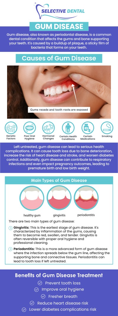 If you're experiencing symptoms of gum disease such as bleeding, swelling, or persistent bad breath, it may be time to see a gum specialist. Dr. Victoria Vuong, DDS, at Selective Dental specializes in diagnosing and treating gum disease, offering advanced treatments to protect your oral health. Regular visits to a gum specialist can help prevent further damage and ensure a healthy smile. Trust Dr. Vuong for proper care tailored to your needs. Contact us today or schedule an appointment online. We are conveniently located at 3151 South White Road, Suite 203 San Jose, CA 95148.