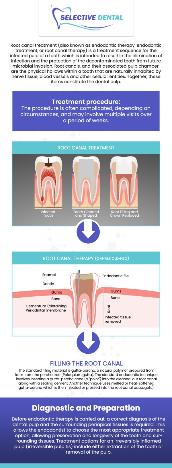 Common Questions Asked by Patients: Is it painful to get a root canal? Is a root canal a serious procedure? What happens during a root canal?

A root canal treatment becomes necessary when there is inflammation or infection in the pulp chamber of a tooth. Visit Selective Dental to get quality and expert care. For more information, contact us today or schedule an appointment online. We are conveniently located at 3151 South White Road, Suite 203 San Jose, CA 95148. We serve patients from all over Santa Clara County CA: San Jose, Milpitas, Santa Clara, Campbell, Sunnyvale, Cupertino, Saratoga, Los Gatos CA, and beyond!