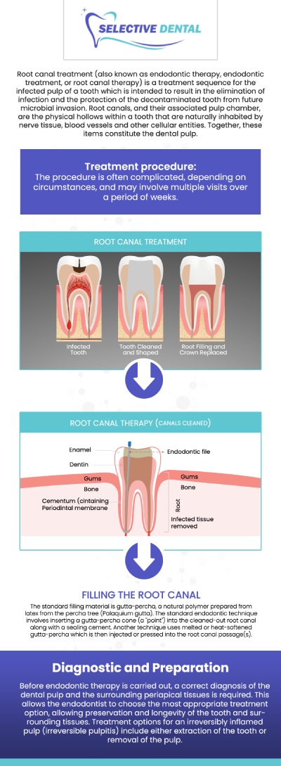 Common Questions Asked by Patients: Is it painful to get a root canal? Is a root canal a serious procedure? What happens during a root canal?

A root canal treatment becomes necessary when there is inflammation or infection in the pulp chamber of a tooth. Visit Selective Dental to get quality and expert care. For more information, contact us today or schedule an appointment online. We are conveniently located at 3151 South White Road, Suite 203 San Jose, CA 95148. We serve patients from all over Santa Clara County CA: San Jose, Milpitas, Santa Clara, Campbell, Sunnyvale, Cupertino, Saratoga, Los Gatos CA, and beyond!