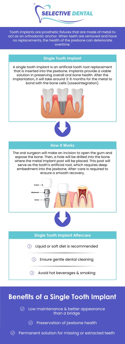 Single tooth implants are an ideal solution for replacing missing teeth while preserving your natural smile. At Selective Dental, we offer high-quality single tooth implant crowns designed to blend seamlessly with your natural teeth. Dr. Victoria Vuong DDS provides personalized care to ensure the best results for each patient. Whether you're looking to replace a single tooth or restore your smile’s full function, we guide you through every step of the implant process with care and precision. Contact us today for more information or schedule an appointment online! We are conveniently located at 3151 South White Road, Suite 203, San Jose, CA 95148.