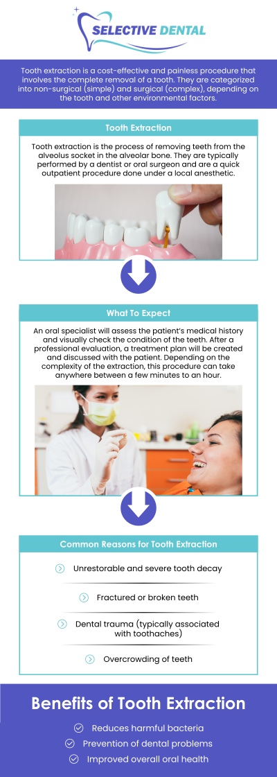 Common questions asked by patients: How painful are tooth extractions? What are the different types of tooth extractions? How long does it take to recover from a tooth extraction? Tooth extraction is a dental procedure during which your tooth is completely removed from its socket. Every patient's condition, outcome, and recovery could be different, so please visit Selective Dental to learn more. For more information, contact us today or schedule an appointment online. We are conveniently located at 3151 South White Road, Suite 203 San Jose, CA 95148. We serve patients from all over Santa Clara County CA: San Jose, Milpitas, Santa Clara, Campbell, Sunnyvale, Cupertino, Saratoga, Los Gatos CA, and beyond! Common questions asked by patients: How painful are tooth extractions? What are the different types of tooth extractions? How long does it take to recover from a tooth extraction?
Tooth extraction is a dental procedure during which your tooth is completely removed from its socket. Every patient's condition, outcome, and recovery could be different, so please visit Selective Dental to learn more. For more information, contact us today or schedule an appointment online. We are conveniently located at 3151 South White Road, Suite 203 San Jose, CA 95148. We serve patients from all over Santa Clara County CA: San Jose, Milpitas, Santa Clara, Campbell, Sunnyvale, Cupertino, Saratoga, Los Gatos CA, and beyond!