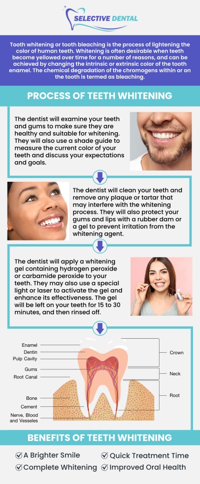 A brighter smile can help enhance confidence and improve overall appearance. At Selective Dental, Dr. Victoria Vuong, DDS, provides personalized teeth whitening care based on each patient’s smile goals, dental health, and the cause of discoloration. Through a detailed evaluation, Dr. Vuong helps determine the most appropriate whitening approach to achieve natural-looking results while prioritizing comfort, safety, and long-term oral health. Our team focuses on providing clear guidance and customized cosmetic dental care to help patients achieve a healthier, more confident smile. For more information, contact us today or schedule an appointment online. We are conveniently located at 3151 South White Road, Suite 203 San Jose, CA 95148. A brighter smile can help enhance confidence and improve overall appearance. At Selective Dental, Dr. Victoria Vuong, DDS, provides personalized teeth whitening care based on each patient’s smile goals, dental health, and the cause of discoloration. Through a detailed evaluation, Dr. Vuong helps determine the most appropriate whitening approach to achieve natural-looking results while prioritizing comfort, safety, and long-term oral health. Our team focuses on providing clear guidance and customized cosmetic dental care to help patients achieve a healthier, more confident smile. For more information, contact us today or schedule an appointment online. We are conveniently located at 3151 South White Road, Suite 203 San Jose, CA 95148.