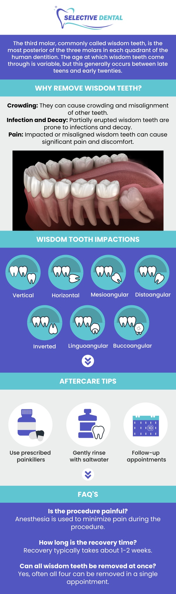 Depending on each individual, wisdom teeth may come in correctly, allowing you to notice signs of eruption, or they may need to be removed if they become impacted or infected. Impacted wisdom teeth can cause pain, swelling, and even lead to further oral health issues if not addressed. As a trusted wisdom tooth dentist, Dr. Victoria Vuong, DDS, at Selective Dental provides expert care to evaluate your wisdom teeth and determine the best course of action. Whether it's monitoring their growth or performing a safe extraction, Dr. Vuong ensures you receive personalized care to maintain your overall oral health. For more information, contact us today or schedule an appointment online. We are conveniently located at 3151 South White Road, Suite 203 San Jose, CA 95148. Depending on each individual, wisdom teeth may come in correctly, allowing you to notice signs of eruption, or they may need to be removed if they become impacted or infected. Impacted wisdom teeth can cause pain, swelling, and even lead to further oral health issues if not addressed. As a trusted wisdom tooth dentist, Dr. Victoria Vuong, DDS, at Selective Dental provides expert care to evaluate your wisdom teeth and determine the best course of action. Whether it's monitoring their growth or performing a safe extraction, Dr. Vuong ensures you receive personalized care to maintain your overall oral health. For more information, contact us today or schedule an appointment online. We are conveniently located at 3151 South White Road, Suite 203 San Jose, CA 95148.
