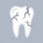 Help Fixing a Damaged Tooth