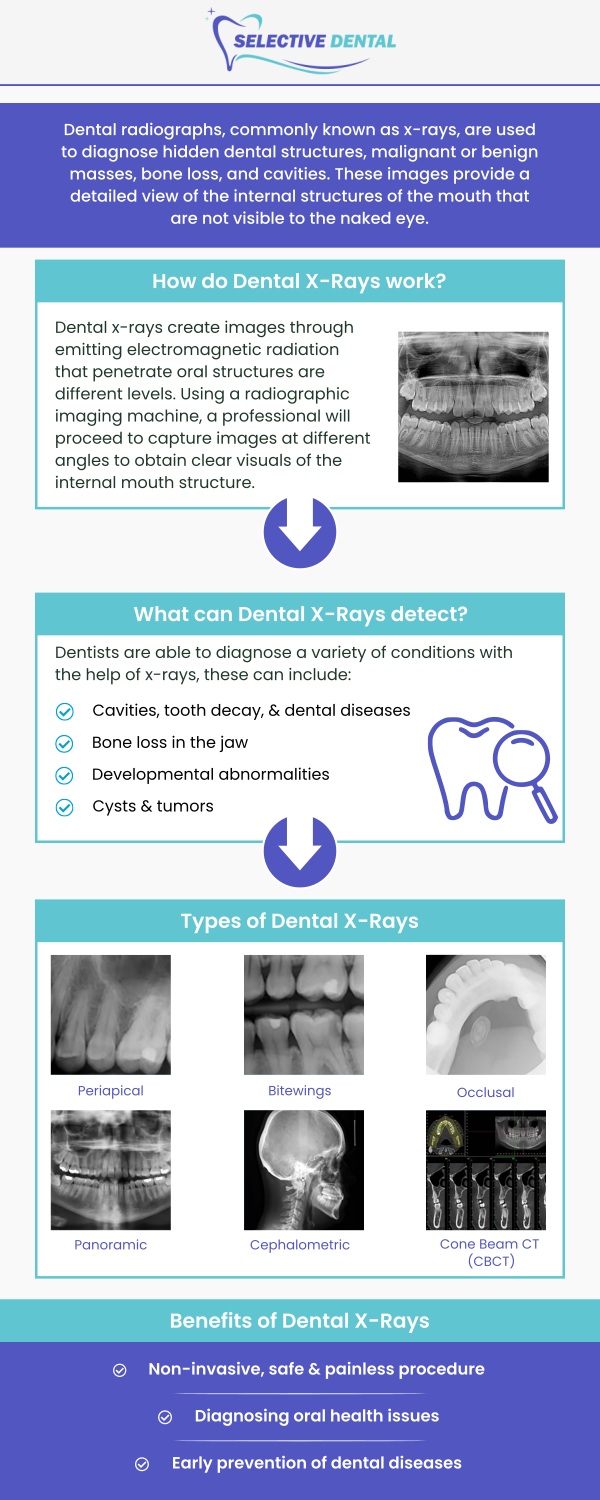 Common questions asked by patients: What are dental X-rays? What can dental radiographs detect? How do dental radiographs work? How are dental X-rays done? Are dental X-rays safe? Can dental X-rays show cancer? At Selective Dental, Dr. Victoria Vuong, DDS, and our team provide dental X-rays in San Jose, CA, to identify concerns that may not be visible during a routine exam. Dental X-rays help our team evaluate teeth, roots, bone health, and other areas to support accurate treatment planning. For more information, contact us now or schedule an appointment online. We are conveniently located at 3151 South White Road, Suite 203 San Jose, CA 95148. Common questions asked by patients: What are dental X-rays? What can dental radiographs detect? How do dental radiographs work? How are dental X-rays done? Are dental X-rays safe? Can dental X-rays show cancer?
At Selective Dental, Dr. Victoria Vuong, DDS, and our team provide dental X-rays in San Jose, CA, to identify concerns that may not be visible during a routine exam. Dental X-rays help our team evaluate teeth, roots, bone health, and other areas to support accurate treatment planning. For more information, contact us now or schedule an appointment online. We are conveniently located at 3151 South White Road, Suite 203 San Jose, CA 95148.