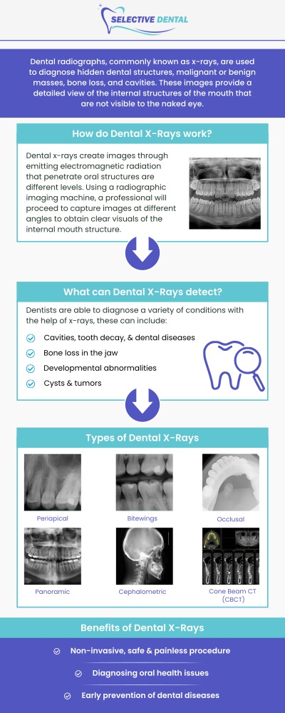 Common questions asked by patients: What are dental X-rays? What can dental radiographs detect? How do dental radiographs work? How are dental X-rays done? Are dental X-rays safe? Can dental X-rays show cancer? At Selective Dental, Dr. Victoria Vuong, DDS, and our team provide dental X-rays in San Jose, CA, to identify concerns that may not be visible during a routine exam. Dental X-rays help our team evaluate teeth, roots, bone health, and other areas to support accurate treatment planning. For more information, contact us now or schedule an appointment online. We are conveniently located at 3151 South White Road, Suite 203 San Jose, CA 95148. Common questions asked by patients: What are dental X-rays? What can dental radiographs detect? How do dental radiographs work? How are dental X-rays done? Are dental X-rays safe? Can dental X-rays show cancer?
At Selective Dental, Dr. Victoria Vuong, DDS, and our team provide dental X-rays in San Jose, CA, to identify concerns that may not be visible during a routine exam. Dental X-rays help our team evaluate teeth, roots, bone health, and other areas to support accurate treatment planning. For more information, contact us now or schedule an appointment online. We are conveniently located at 3151 South White Road, Suite 203 San Jose, CA 95148.